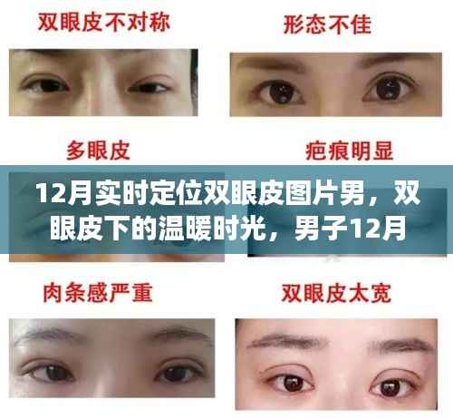 男子双眼皮恢复之旅，冬季温暖时光与友情的碰撞