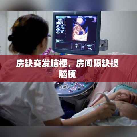 房缺突发脑梗,房间隔缺损 脑梗