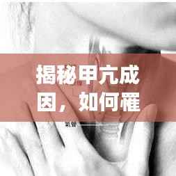 揭秘甲亢成因,如何罹患甲状腺功能亢进?